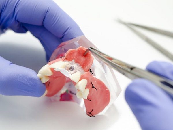 ضرایب دروس کنکور تجربی برای دندانپزشکی